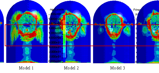 Figure 15 Concrete plastic strain at t = 0.45 s (v = 100 m/s)